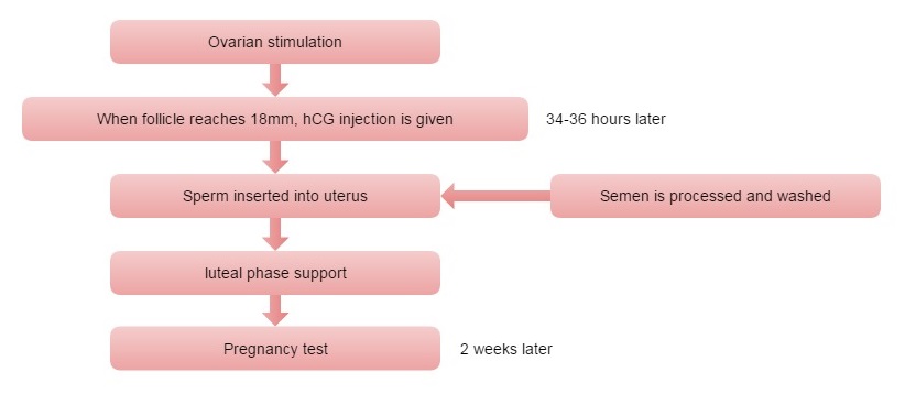 analysis iui Sperm Karz recommend Mature upskirt powered by phpbb